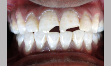 Dental clinic in Anand
                        